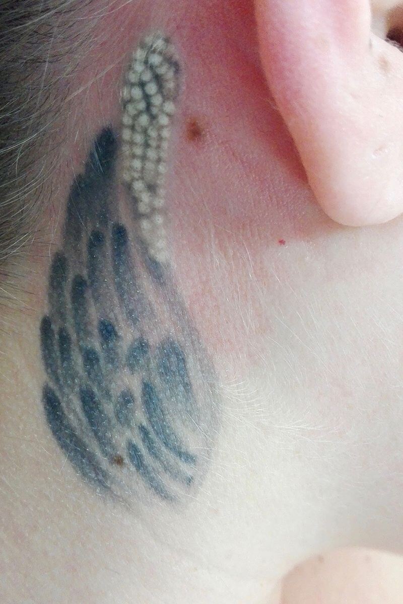 1. Tattoolaser 10/16